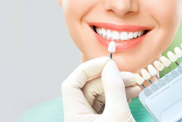Teeth Whitening