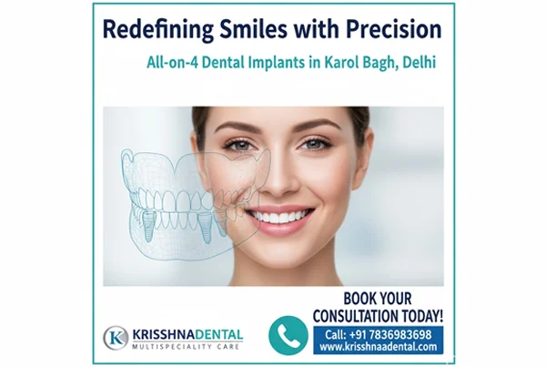 Allon4 Dental Implants in Delhi  Krisshnaa Dental Karol Bagh