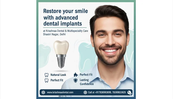 Single Tooth Implants in Karol Bagh, Delhi  Permanent Tooth Replacement  Krisshnaa Dental
