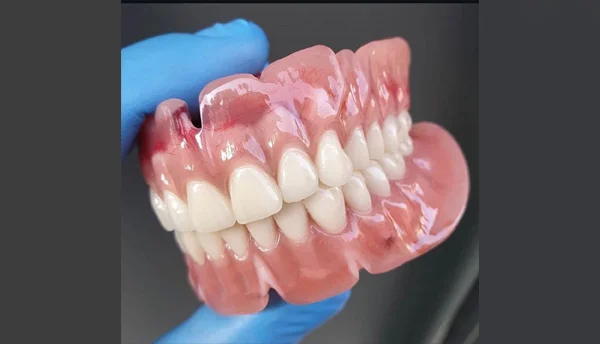 Complete Denture Treatment in Karol Bagh, Delhi