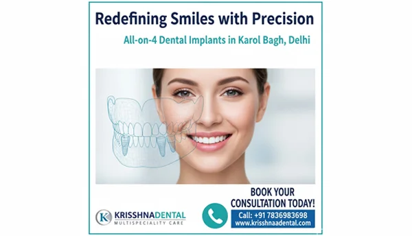 All on 4 Dental Implants in Karol Bagh delhi